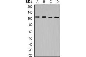 Western blot analysis of JHDM1D expression in Hela (A), HEK293T (B), mouse spleen (C), rat brain (D) whole cell lysates.