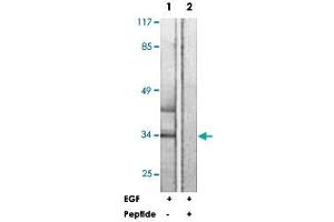 Western blot analysis of extracts from HUVEC cells, treated with EGF (200 ng/ml, 5 mins), using HNRNPC polyclonal antibody . (HNRNPC antibody  (Ser260))