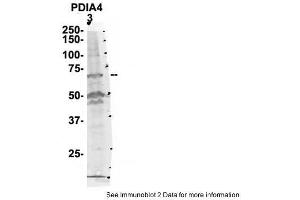 Sample Type: 3. (PDIA4 antibody  (N-Term))