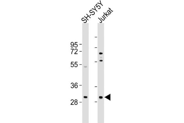 TRMT61A antibody  (N-Term)