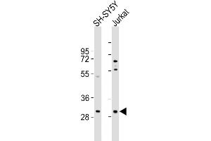 All lanes : Anti-TRMT61A Antibody (N-term) at 1:1000 dilution Lane 1: SH-SY5Y whole cell lysates Lane 2: Jurkat whole cell lysates Lysates/proteins at 20 μg per lane. (TRMT61A antibody  (N-Term))