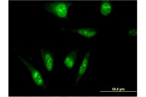 Immunofluorescence of monoclonal antibody to TAF7L on HeLa cell. (TAF7L antibody  (AA 231-332))