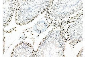 ABIN6259030 and ABIN6273465 at 1/100 staining Rat testis tissue by IHC-P.