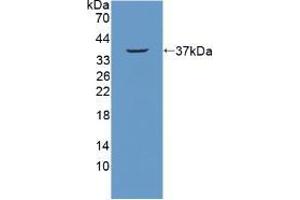 Western blot analysis of recombinant Mouse NUP214.