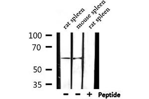Western blot analysis of extracts from rat spleen,mouse spleen, using Cytochrome P450 2D6 Antibody. (CYP2D6 antibody)