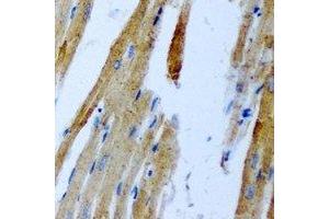 Immunohistochemical analysis of GnT-III staining in rat heart formalin fixed paraffin embedded tissue section. (MGAT3 antibody)