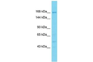 Host: Rabbit Target Name: DDX60L Sample Type: PANC1 Whole Cell lysates Antibody Dilution: 1. (DDX60L antibody  (N-Term))