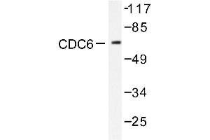 Image no. 1 for anti-Cell Division Cycle 6 Homolog (S. Cerevisiae) (CDC6) antibody (ABIN265343) (CDC6 antibody)