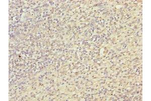 Immunohistochemistry of paraffin-embedded human spleen tissue using ABIN7172018 at dilution of 1:100 (TXNRD1 antibody  (AA 1-497))