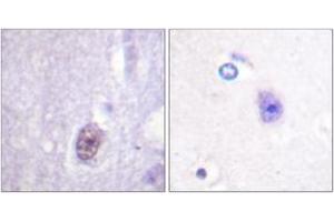 Immunohistochemistry analysis of paraffin-embedded human brain, using SP1 (Phospho-Thr453) Antibody. (SP1 antibody  (pThr453))