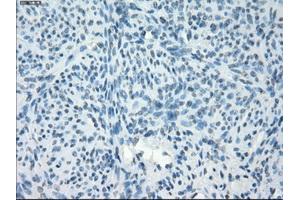 Immunohistochemical staining of paraffin-embedded endometrium tissue using anti-PDE10A mouse monoclonal antibody.