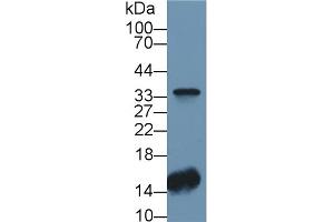 Detection of CA4 in Human Lung lysate using Polyclonal Antibody to Carbonic Anhydrase IV (CA4) (CA4 antibody  (AA 19-283))