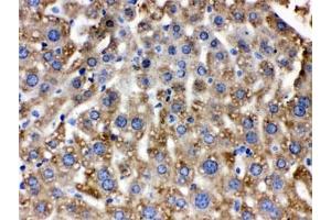 IHC testing of FFPE mouse liver with Catalase antibody. (Catalase antibody)