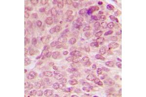 Immunohistochemistry (IHC) image for anti-Tumor Protein P53 (TP53) (N-Term), (pSer15) antibody (ABIN7297184)