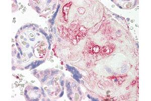 Immunohistochemistry (IHC) image for anti-Purinergic Receptor P2Y, G-Protein Coupled, 1 (P2RY1) (AA 71-120) antibody (ABIN6749750)