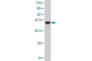 Western Blot detection against Immunogen (36. (KAT2B antibody  (AA 353-452))