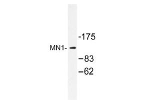 Image no. 1 for anti-MN1 proto-oncogene (MN1) antibody (ABIN317611) (Meningioma 1 antibody)