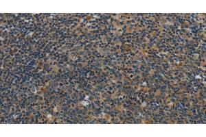 Immunohistochemistry of paraffin-embedded Human tonsil using SYN1 Polyclonal Antibody at dilution of 1:40 (SYN1 antibody)