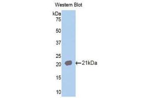 Western Blotting (WB) image for anti-Interleukin 18 Receptor 1 (IL18R1) (AA 391-518) antibody (ABIN1859373) (IL18R1 antibody  (AA 391-518))