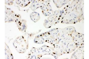 Immunohistochemistry (IHC) image for anti-Poly (ADP-Ribose) Polymerase 1 (PARP1) (AA 670-858) antibody (ABIN3043378)