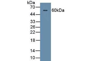 Detection of Recombinant CDSN, Human using Polyclonal Antibody to Corneodesmosin (CDSN) (Corneodesmosin antibody  (AA 33-300))