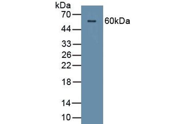 Corneodesmosin Antikörper  (AA 33-300)