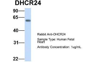 Host:  Rabbit  Target Name:  DHCR24  Sample Type:  Human Fetal Heart  Antibody Dilution:  1. (Seladin 1 antibody  (N-Term))