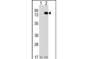 Western blot analysis of RIOK1 (arrow) using rabbit polyclonal RIOK1 Antibody (N-term) (ABIN391301 and ABIN2841337). (RIOK1 antibody  (N-Term))