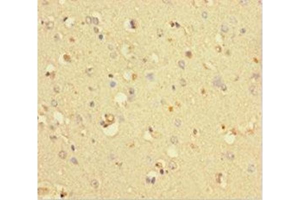 COMMD6 antibody  (AA 1-85)