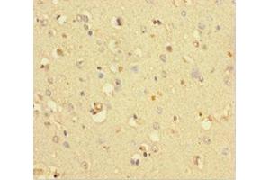 Immunohistochemistry of paraffin-embedded human brain tissue using ABIN7148316 at dilution of 1:100
