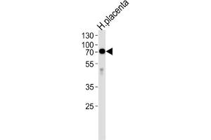 Western Blotting (WB) image for anti-Alkaline Phosphatase (ALP) antibody (ABIN2998256) (Alkaline Phosphatase antibody)