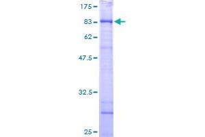 CCT6B Protein (AA 1-530) (GST tag)