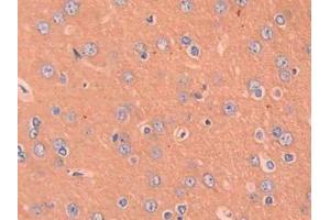 DAB staining on IHC-P; Samples: Rat Cerebrum Tissue (CCL4 antibody  (AA 24-92))