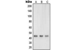 Western blot analysis of Neuregulin SMDF expression in A431 (A), A673 (B), SKNMC (C) whole cell lysates. (Neuregulin SMDF (N-Term) antibody)