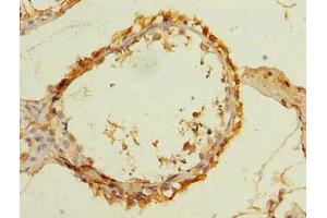 Immunohistochemistry of paraffin-embedded human testis tissue using ABIN7170183 at dilution of 1:100 (SLC25A33 antibody  (AA 66-120))