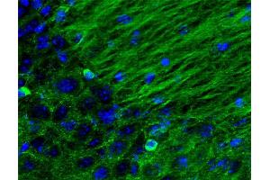 Immunohistochemistry (IHC) image for anti-tau Protein (AA 3-214) antibody (ABIN1742567) (tau antibody  (AA 3-214))