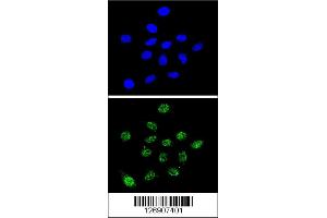 Confocal immunofluorescent analysis of DKC1 Antibody with 293 cell followed by Alexa Fluor 488-conjugated goat anti-rabbit lgG (green).