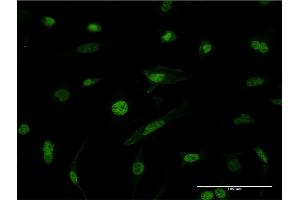 Immunofluorescence of monoclonal antibody to HNRNPM on HeLa cell. (HNRNPM antibody  (AA 17-112))