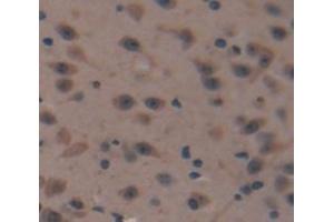 IHC-P analysis of Mouse Tissue, with DAB staining. (MGP antibody  (AA 20-104))