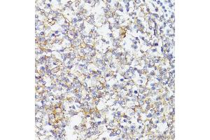 Immunohistochemistry of paraffin-embedded Human tonsil using CD276/B7-H3 antibody (ABIN7266182) at dilution of 1:100 (40x lens). (CD276 antibody  (AA 100-200))