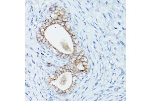 Immunohistochemistry of paraffin-embedded rat uterus using δ-Catenin/p120 Catenin Rabbit pAb (ABIN3022308, ABIN3022309, ABIN3022310, ABIN1512791 and ABIN6218725) at dilution of 1:50 (40x lens).