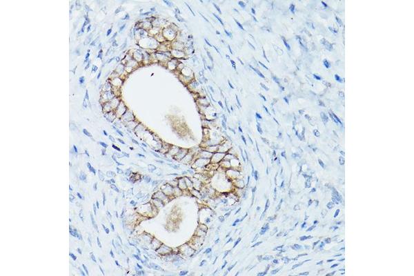 CTNND1 antibody  (AA 573-832)