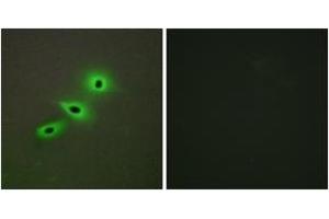 Immunofluorescence analysis of A549 cells, using Cytochrome P450 19A1 Antibody. (Aromatase antibody  (AA 221-270))