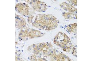 Immunohistochemistry of paraffin-embedded human gastric using FGF13 antibody at dilution of 1:100 (x40 lens). (FGF13 antibody)