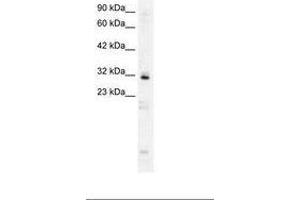 Image no. 2 for anti-Homeobox B9 (HOXB9) (AA 67-116) antibody (ABIN6735813) (HOXB9 antibody  (AA 67-116))