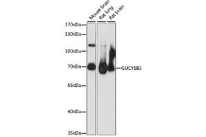 Western blot analysis of extracts of various cell lines, using GUCY1B3 antibody. (GUCY1B3 antibody)