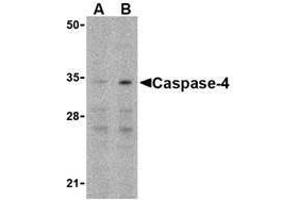 Western blot analysis of Caspase-4 in Ramos cells with Caspase-4 antibody at (A) 0. (Caspase 4 antibody  (N-Term))