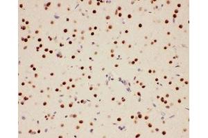 Immunohistochemistry (IHC) image for anti-Protein Inhibitor of Activated STAT, 1 (PIAS1) (AA 636-651) antibody (ABIN3032369)