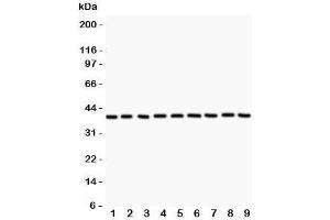 Western blot testing of APE1 antibody and Lane 1:  rat NRK;  2: human HeLa;  3: (r) PC12;  4: (r) RH35;  5: mouse HEPA;  6: (h) MCF7: (h) A549;  8: (h) placenta;  9: (h) A431.
