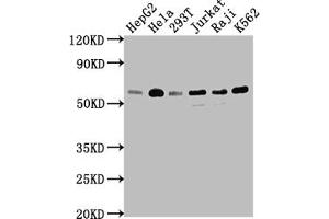 Western Blot Positive WB detected in: HepG2 whole cell lysate, Hela whole cell lysate, 293T whole cell lysate, Jurkat whole cell lysate, Raji whole cell lysate, K562 whole cell lysate All lanes: TRAF2 antibody at 1:1500 Secondary Goat polyclonal to rabbit IgG at 1/50000 dilution Predicted band size: 56, 62, 55, 54 kDa Observed band size: 56 kDa